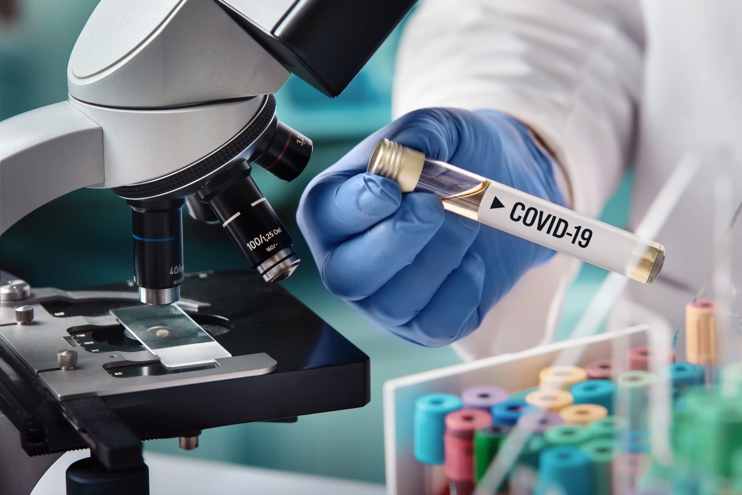 scientists holds a vile test for coronavirus labeled COVID-19